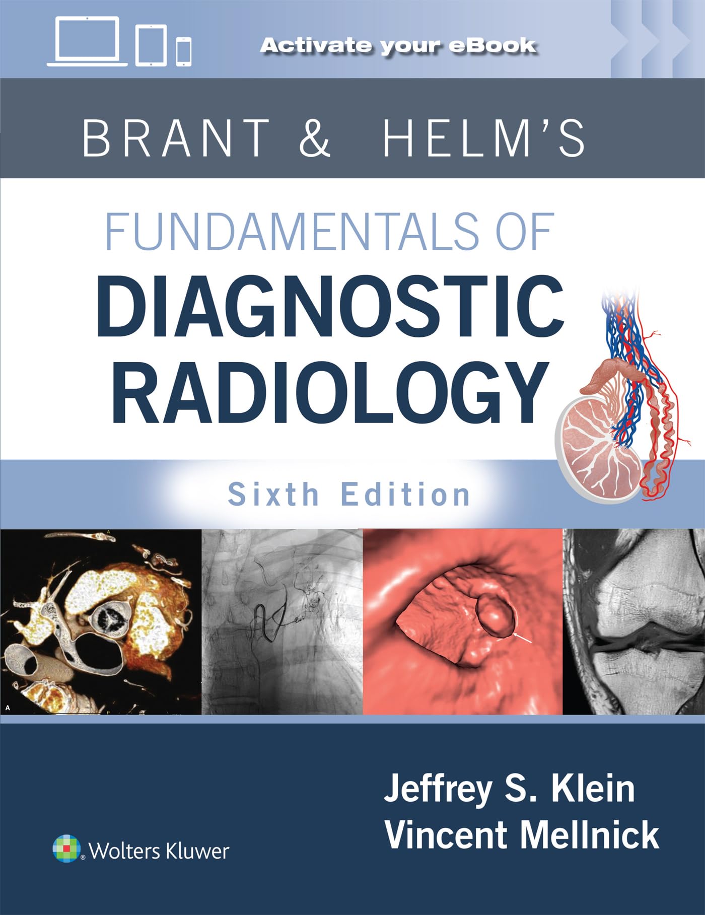 Brant and Helms' Fundamentals of Diagnostic Radiology: Print +
